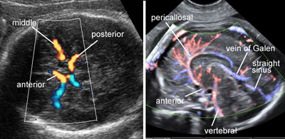 Ultrasound Atlas | GLOWM