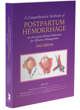 A Comprehensive Textbook of Postpartum Hemorrhage, 2nd Edition