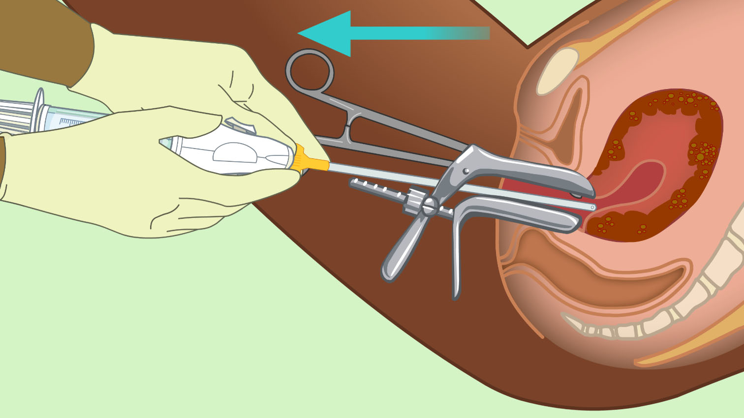 wow-l2-abortion-care-id10086-03.jpg