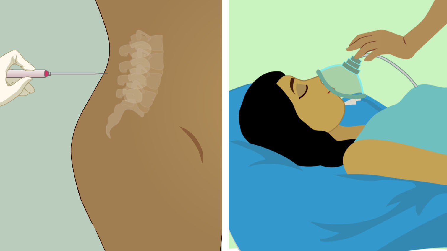 wow-l2-cesarean-section-id10061-03.jpg
