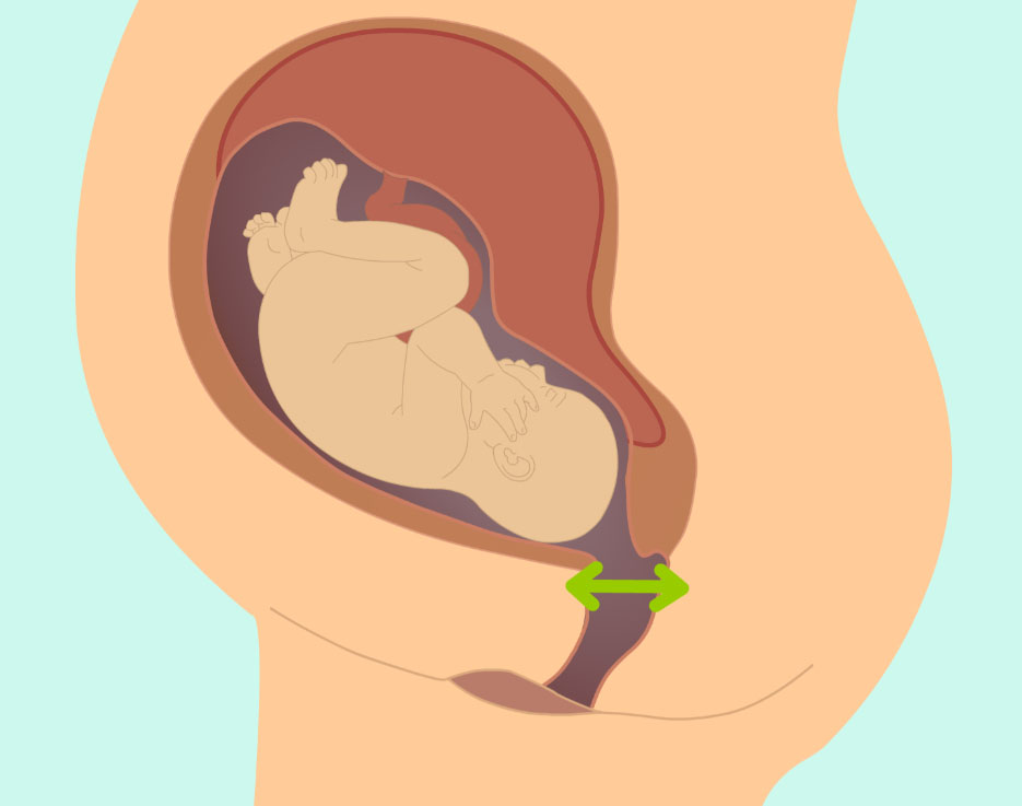 wow-l2-labor-and-birth-id10064-01a.jpg