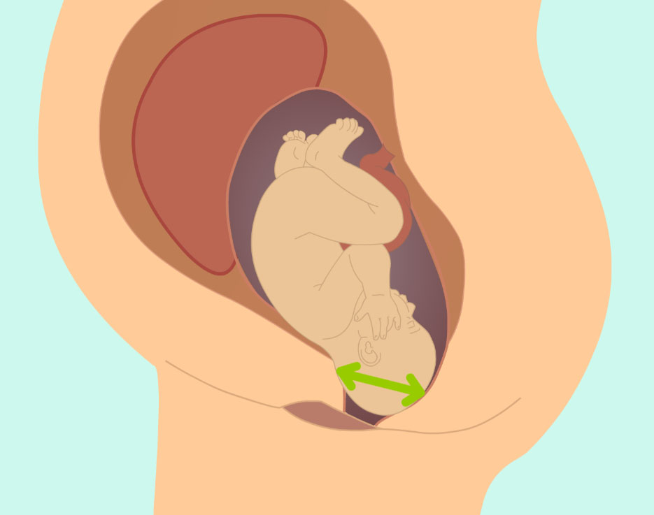 wow-l2-labor-and-birth-id10064-01b.jpg