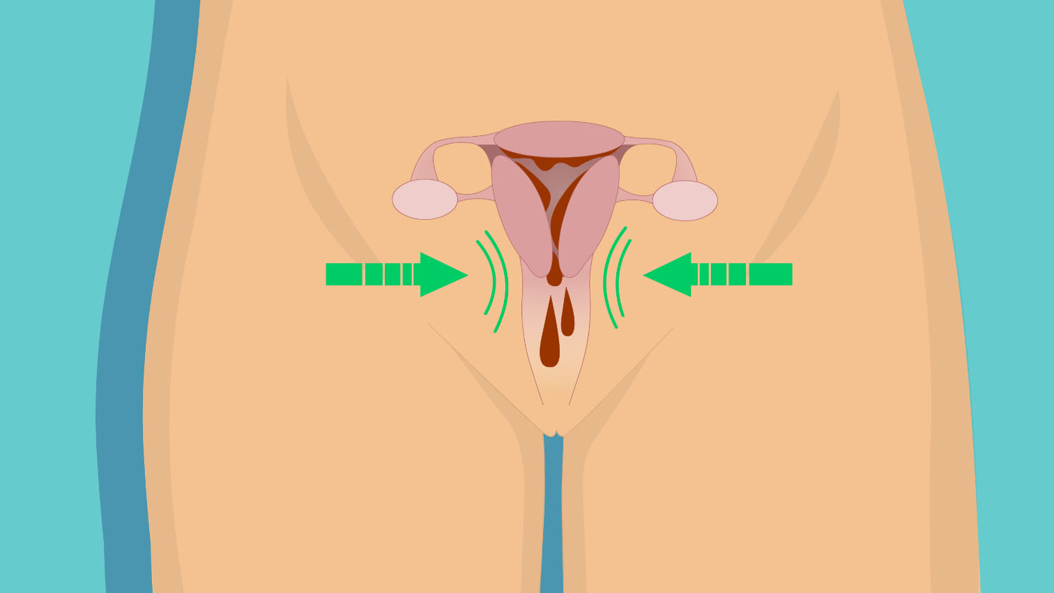 wow-l2-painful-periods-and-heavy-menstrual-bleeding-id10068-01.jpg