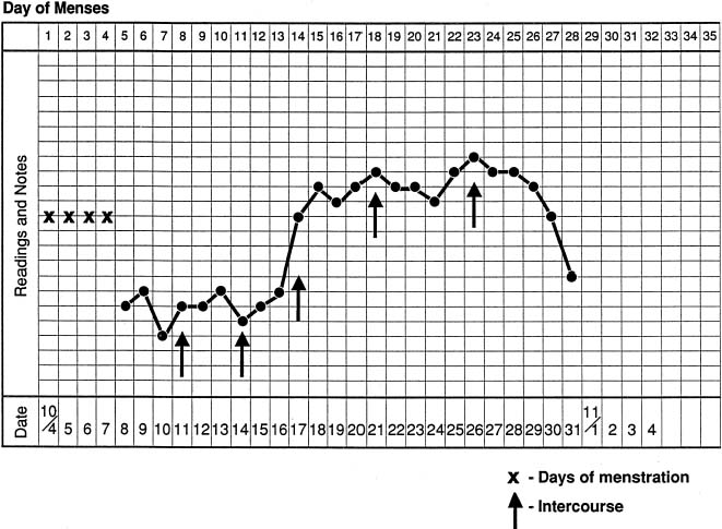 Ectopic Pregnancy Bbt Chart