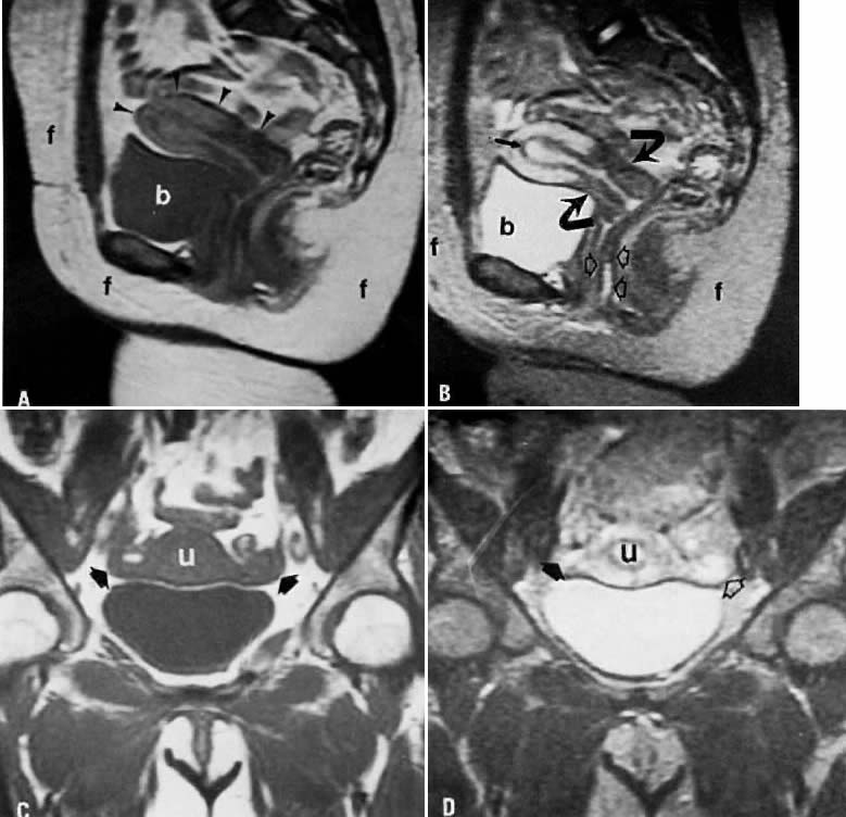 MRI Atlas GLOWM MRI Atlas GLOWM